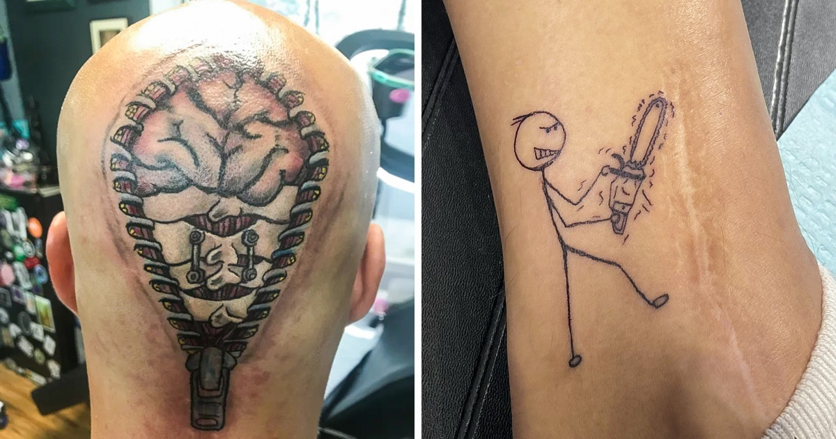 16 People Who Used The Art Of Tattoos To Cover Up Their Scars Bright Side 16 People Who Used The Art Of Tattoos To Cover Up Their Scars Bright Side