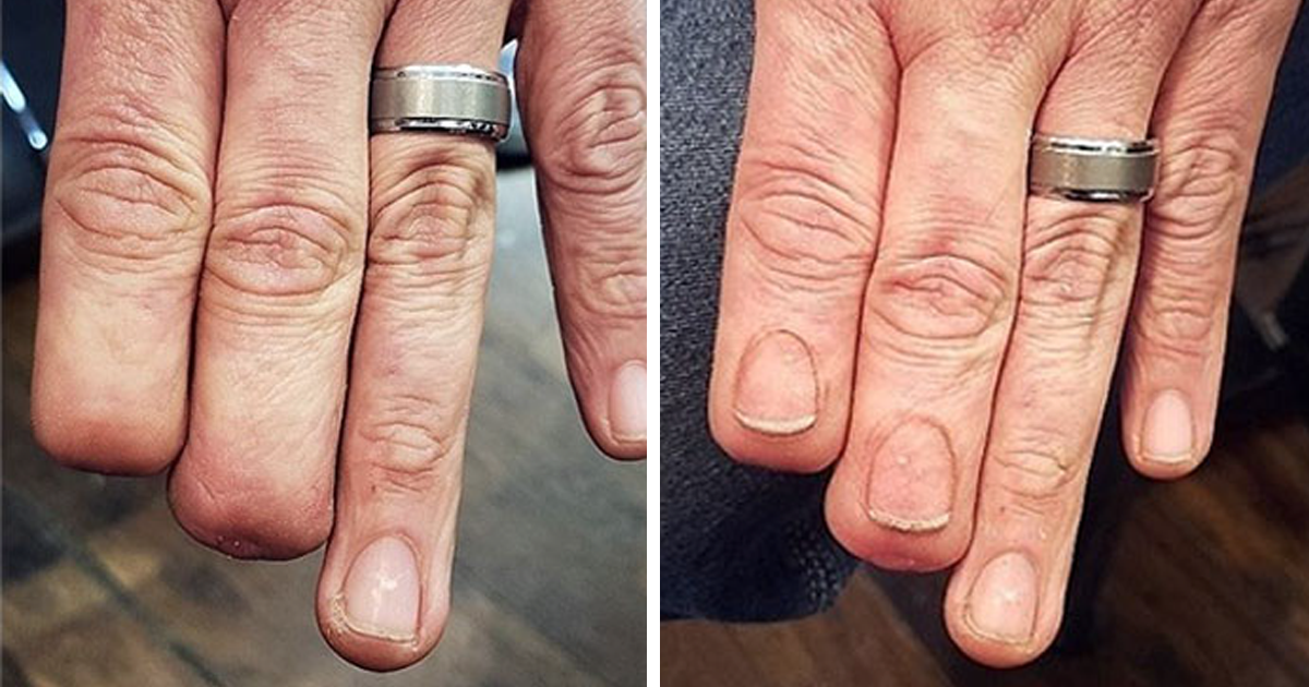 50 Amazing Scar Cover Up Tattoos Demilked 50 Amazing Scar Cover Up Tattoos Demilked