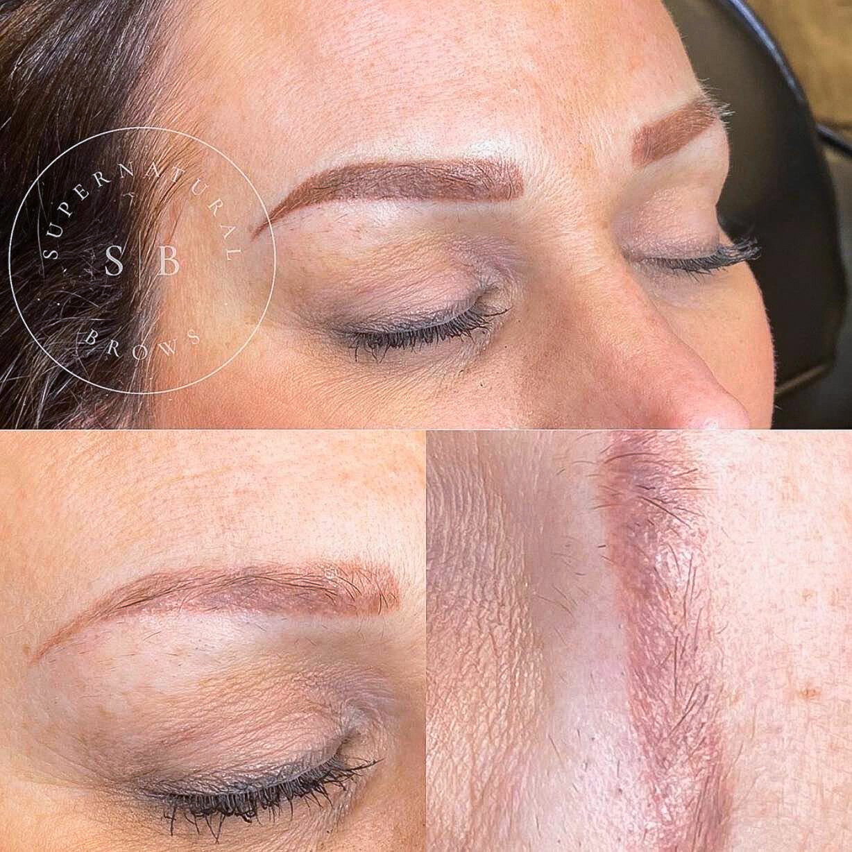 Aggregate 77 Tattoo Eyebrow Removal In Cdgdbentre Aggregate 77 Tattoo Eyebrow Removal In Cdgdbentre